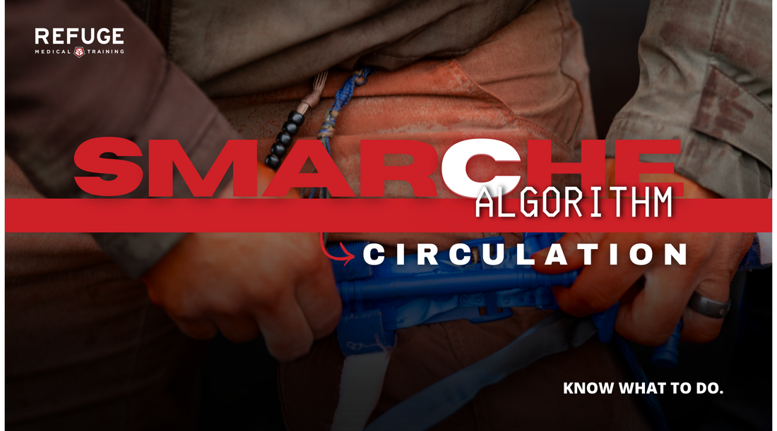 Circulation in the SMARCH-E Algorithm: Why It Matters and How to Respond